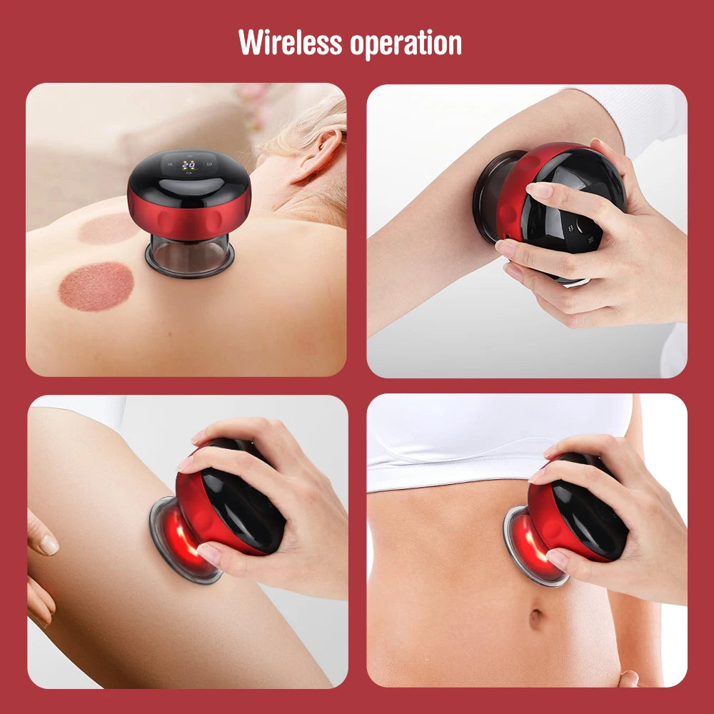 Electric Vacuum Cupping Massager – Vacuum cupping for anti-cellulite